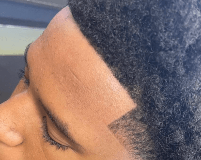 TAPER